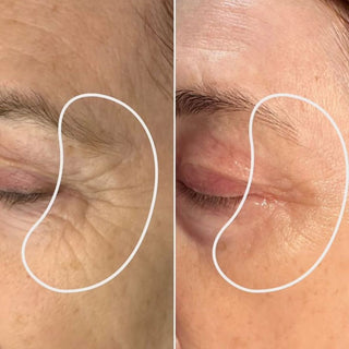 Hair + Skin Regeneration Peptide